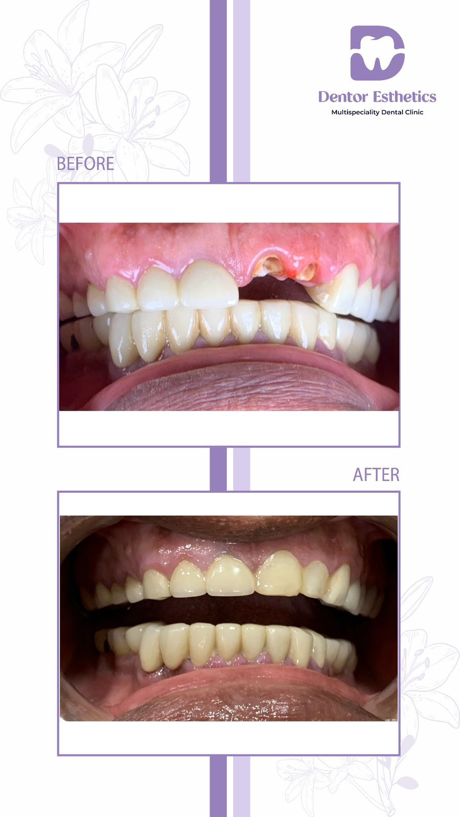 WhatsApp Image 2025-06-14 at 10.46.36 PM.jpeg