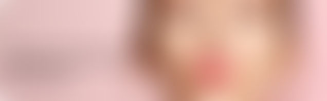 Lip Fillers Singapore Price: Everything You Need to Know