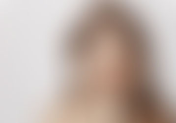 Yellow Laser: Advanced Treatment for Pigmentation and Skin Rejuvenation