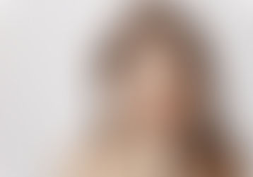 Dual Yellow Laser Treatment Cost: What You Need to Know