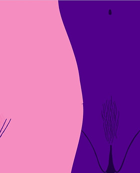 7478-Lopsided_Vagina-_Are_My_Labia_Norma