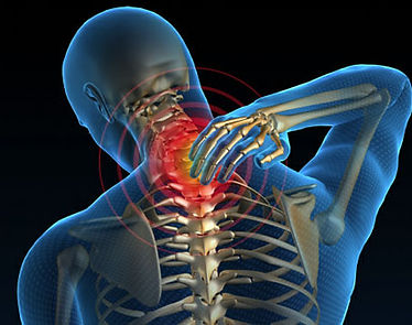 Neck Pain & Radiating Arm Pain