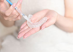 ホームホワイトニングの準備