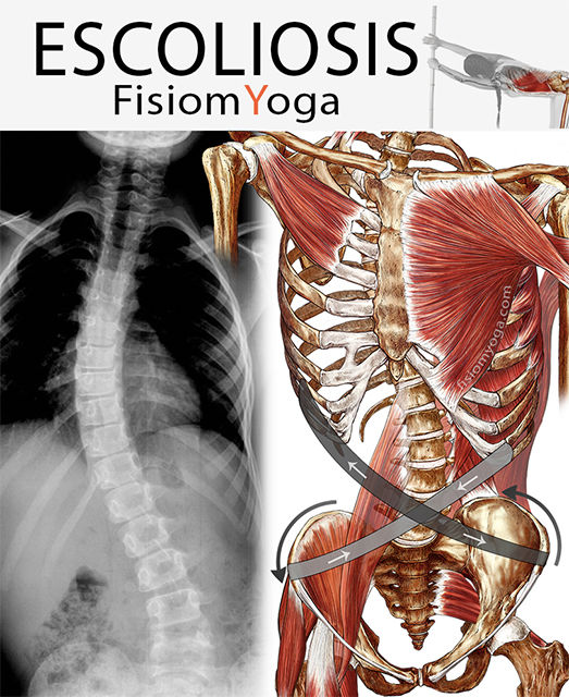 Escoliosis Estructurada Y No Estructurada ESCOLIOSIS. El curso definitivo