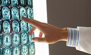 Brain Injuries