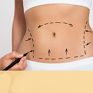 產後紮肚