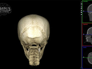 Revolutionary Upper Cervical Care