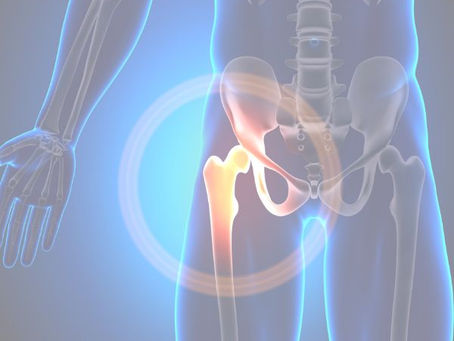 3D image of a hip x-ray