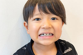 歯列矯正器具をつけた男の子