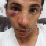 Assaulted minor; Photo courtesy of the family