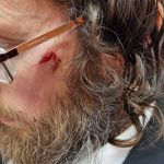 Arabs attack hareidi man at Sha’ar Shechem