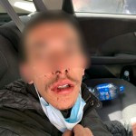 The assault victim; Photo credit: Free use