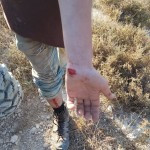 One of the injured youths; Photo credit: Courtesy of the photographer