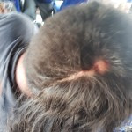 Injured protester; Photo credit: Free use