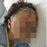The injured youth; Photo credit: Courtesy of the family