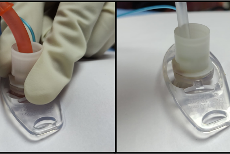 Tracheostomy tube care