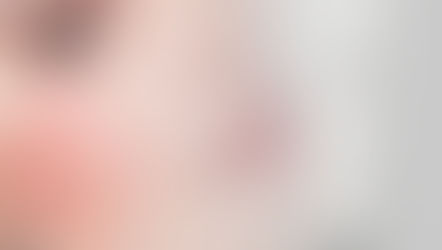 Saveti kod kuperozne kože