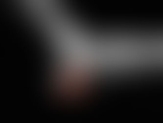 Plantar Heel Spurs: Probably not the Cause of Your Pain | Find Your Stride | Edinburgh Podiatrist