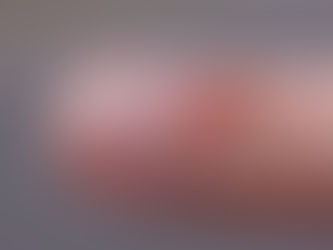 Could it be a Myxoid Cyst? | Find Your Stride | Podiatrist Edinburgh