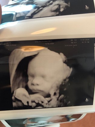 26-week fun ultrasound