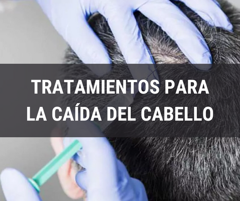 Tratamientos para la caÃda del cabello
