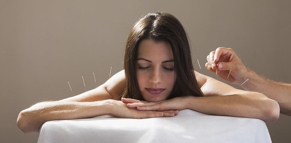 woman with acupuncture needles applied to upper arms.jpg
