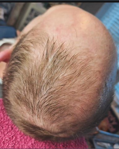 Significant growth post-treatment