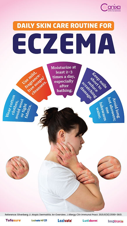 ECZEMA Patient Education Posters