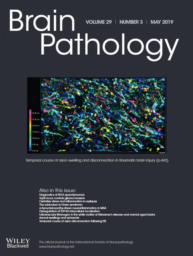 Differential expression of chemokine receptors CX3CR1 and CCR1 by microglia and macrophages in myelin-oligodendrocyte-glycoprotein-induced.. content media