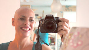 La autoimagen del paciente oncológico: adaptarse a los cambios físicos