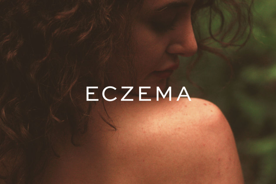 Woman with eczema free skin