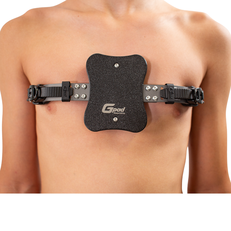 Cómo afecta una ortesis de alta calidad y conforme a estándares al tratamiento del pectus carinatum