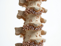Best Supplements for Degenerative Disc Disease: What Helped Me, What Research Says, and What to Ask Your Doctor