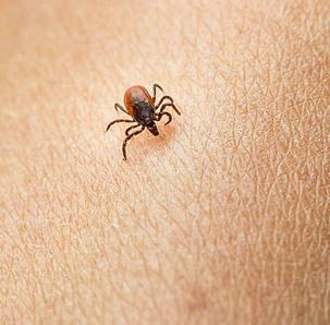 istanbul böcek ilaçlama,istanbul haşere ilaçlama,seyrantepe böcek ilaçlama ,seyrantepe haşere ilaçlama,kağıthane böcek ilaçlama,kağıthane haşere ilaçlama,gültepe böcek ilaçlama,gültepe haşere ilaçlama,çeliktepe böcek ilaçlama,çeliktepe haşere ilaçlama,sanayi mahallesi böcek ilaçlama,sanayi mahallesi haşere ilaçlama,maslak böcek ilaçlama,maslak haşere ilaçlama,beşiktaş böcek ilaçlama,beşiktaş haşere ilaçlama,sarıyer böcek ilaçlama,sarıyer haşere ilaçlama,kadıköy böcek ilaçlama,kadıköy haşere ilaçlama,maltepe böcek ilaçlama,maltepe haşere ilaçlama,küçükyalı böcek ilaçlama,küçükyalı haşere ilaçlama,aydınevler böcek ilaçlama,arnavutköy böcek ilaçlama,arnavutköy haşere ilaçlama,ortaköy böcek ilaçlama,üsküdar böcek ilaçlama,