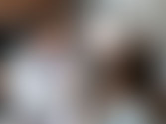 Austin patient learning who should avoid dental implants.