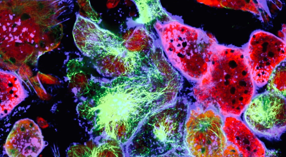 Unified Paradigm of Cancer Causation (UPCC)