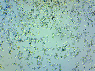 The Science Behind Kombucha Fermentation Unpacking the Yeast and Bacteria Balance