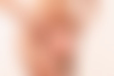 Ninfoplastia: cirurgia íntima melhora a autoestima da mulher