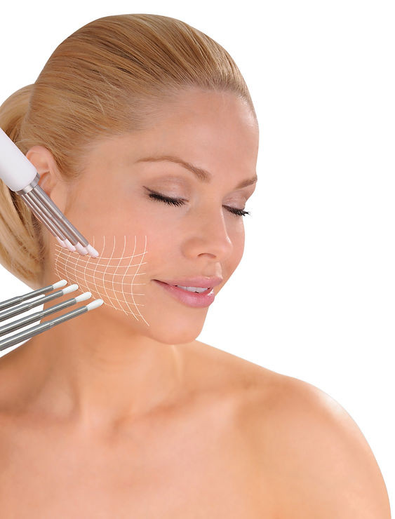 caci jowl lift.jpg