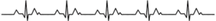 heartbeat_wave-removebg-preview_edited.png
