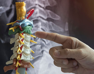 Cervical Spine Disc Bulge and Herniation.jpg