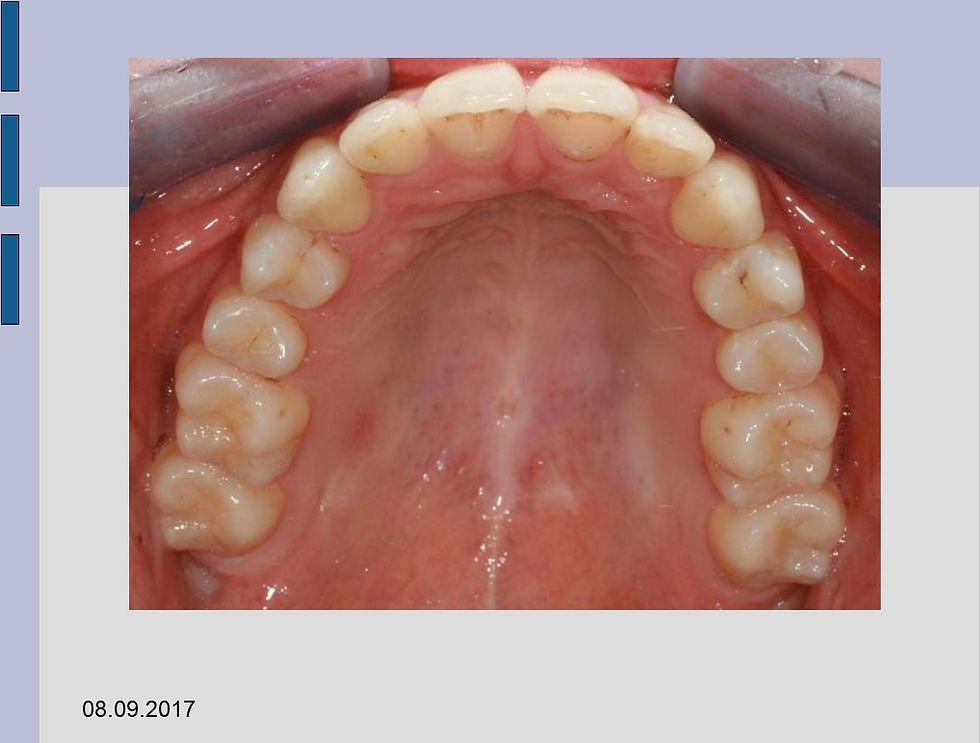 Slide19