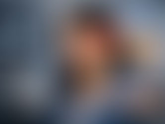 Paciente con dolor en el oído evaluada mediante resonancia magnética de oídos para diagnóstico de vértigo y tinnitus en Quito.