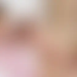 Healing Abdominal Separation After Pregnancy: How Physiotherapy Helps