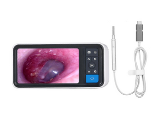 NYHET! Digital øregangsundersøkelse