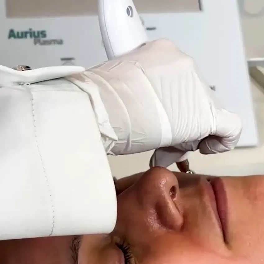 Miniatura: Aurius Plasma