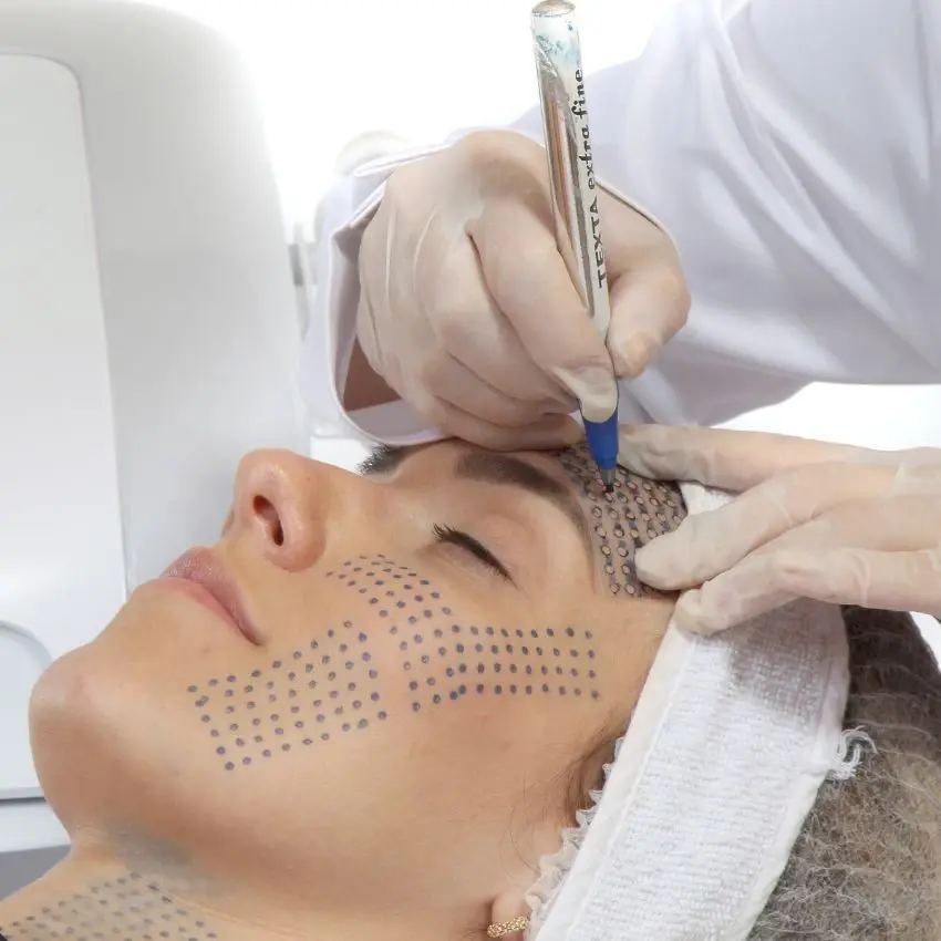 Miniatura: Ultrafocus - Ultrassom Micro e Macrofocado