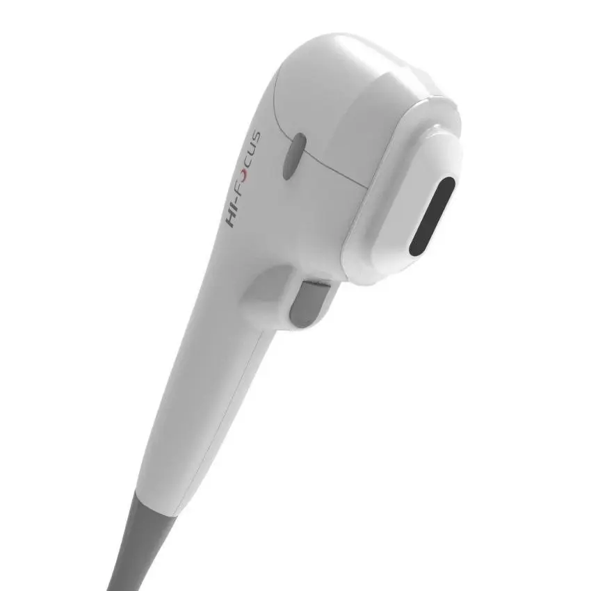 Miniatura: HI-Focus - Ultrassom focalizado de alta intensidade (HIFU)