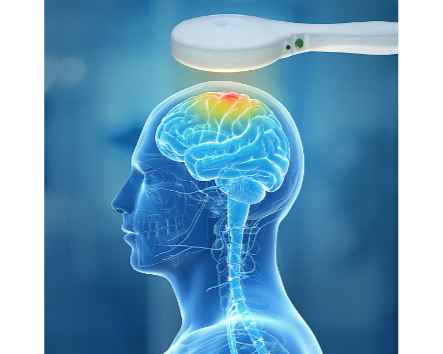 Miniatura: Neuro MSD