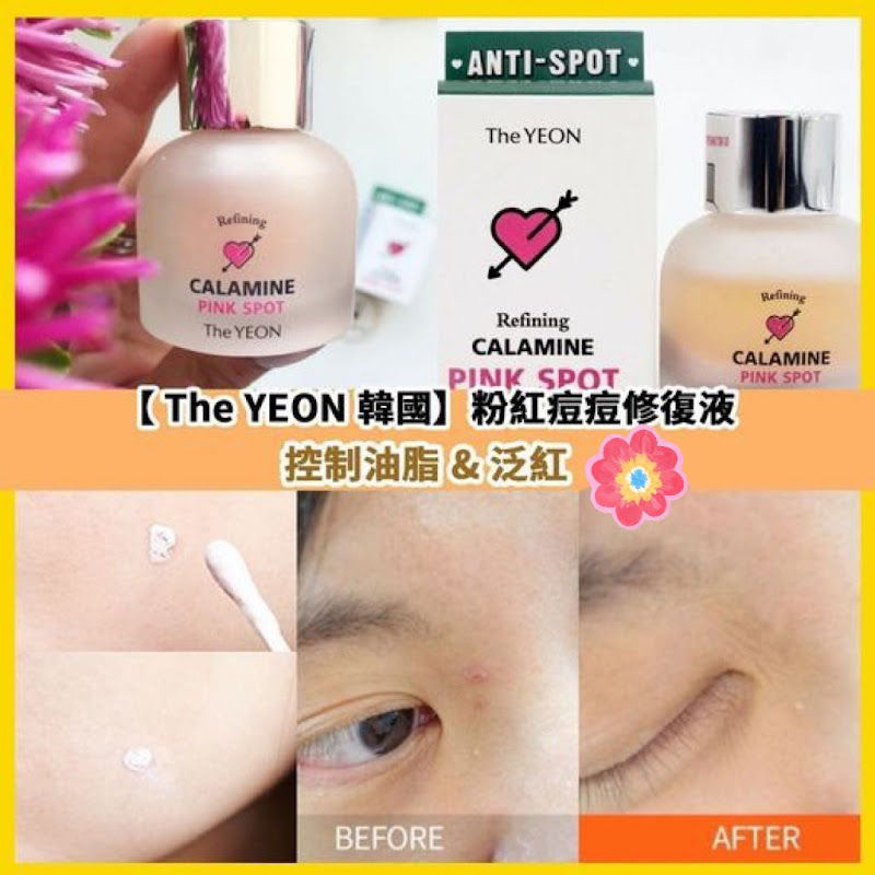 韓國Yeon極速去痘痘水 NYY4312080